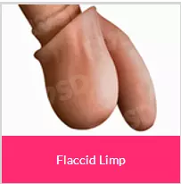 Flaccid limp