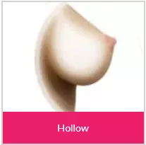 Hollow breast